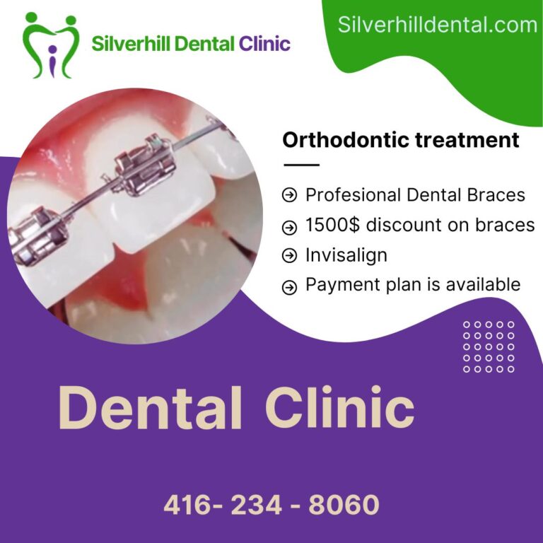 Space in Teeth