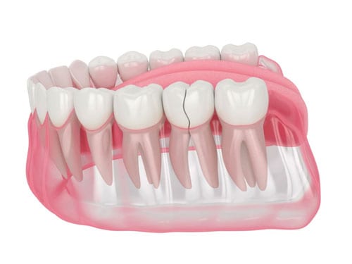 Teeth are protected by a hard outer layer