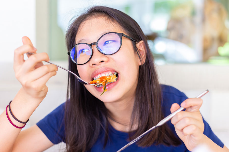 Foods to Avoid While in Braces
