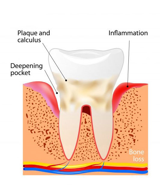What is a PERIODONTIST?