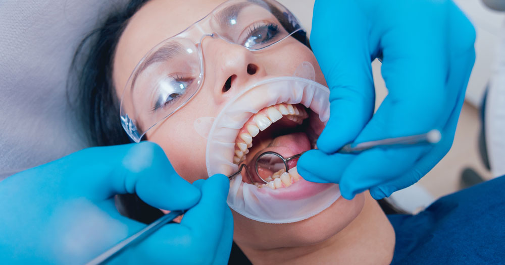 Tooth Scaling and Aftercare