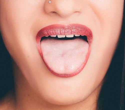 Oral lichen planus