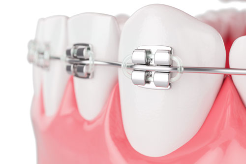 What is orthodontics