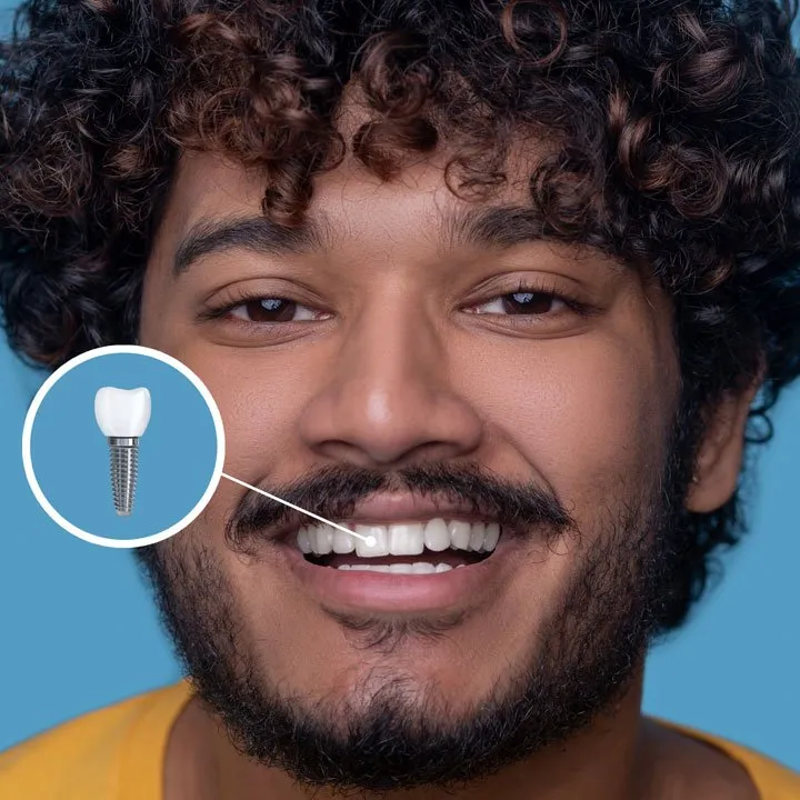 Gum Diseases And Dental Implants