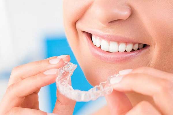 Invisible orthodontics
