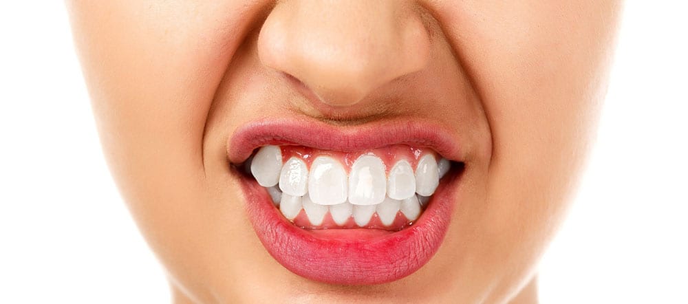 Two groups of orthodontic treatments