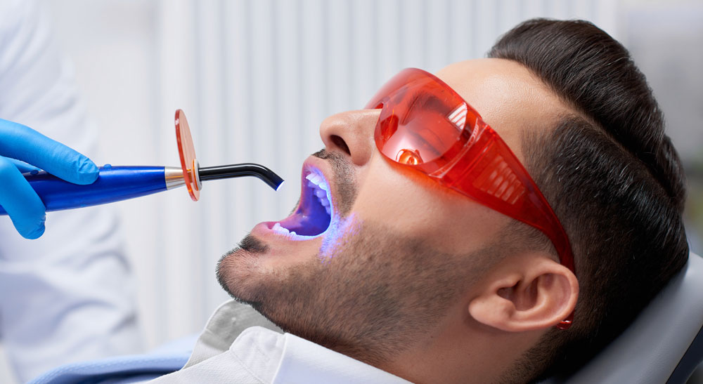 Dental Filling