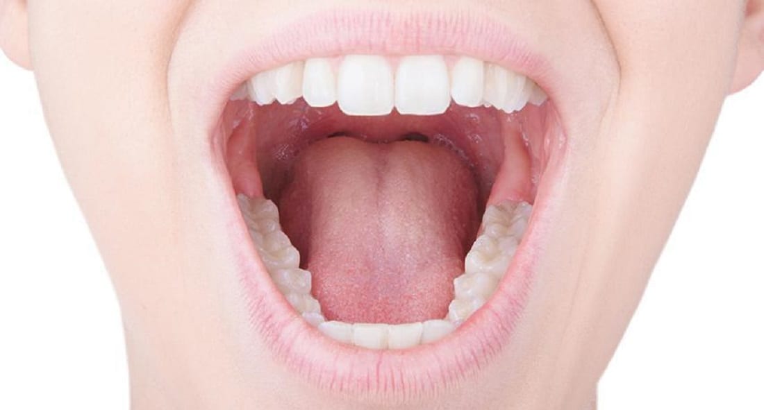 Dry Mouth