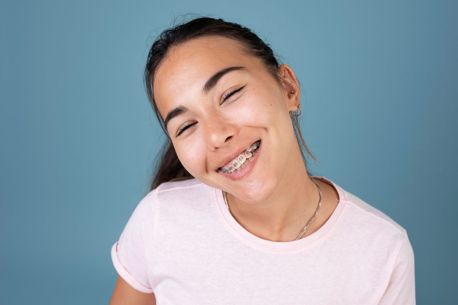 10 Things to Know When Getting Braces