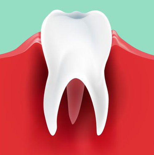 gingival