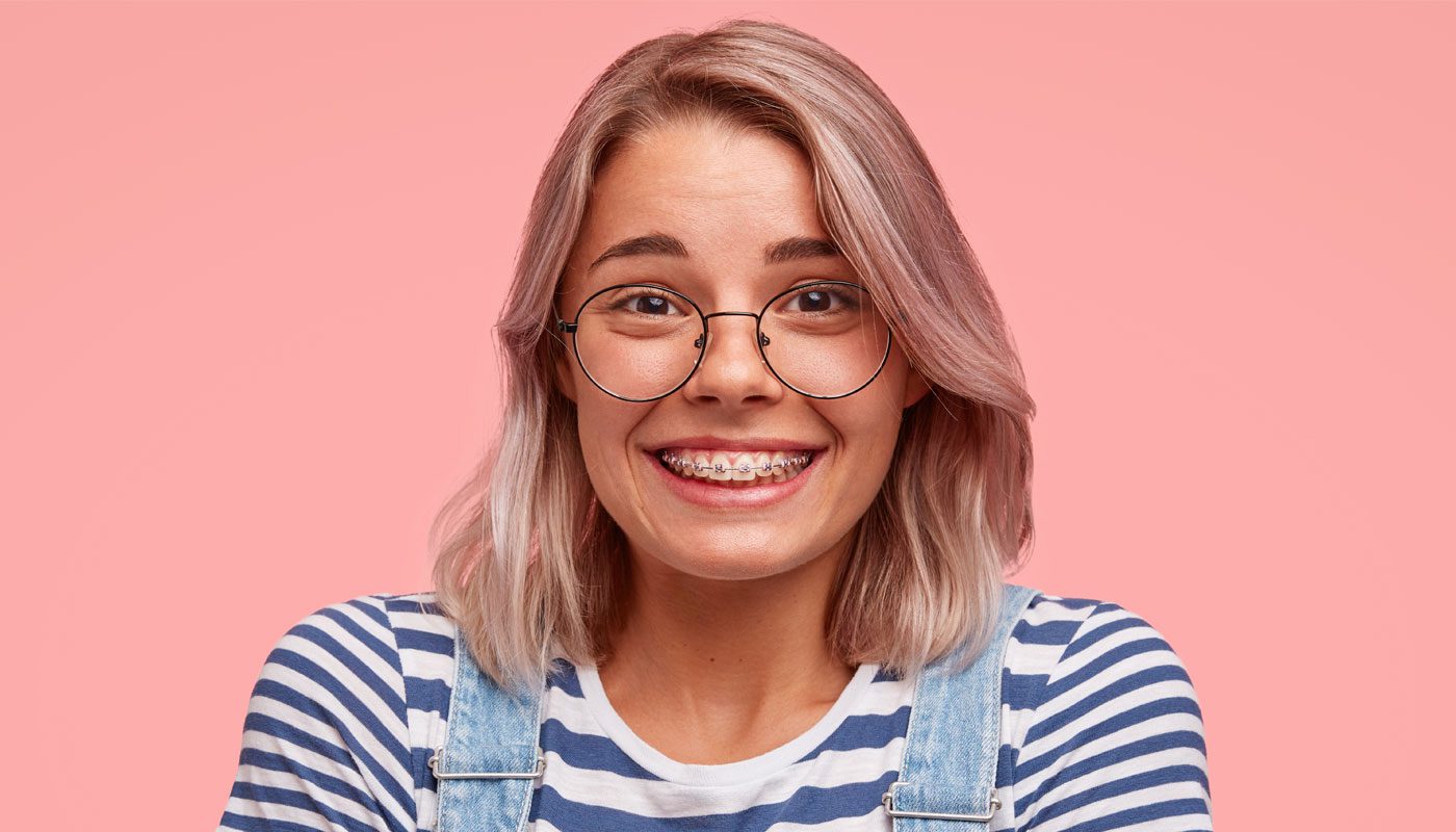 Braces Colors