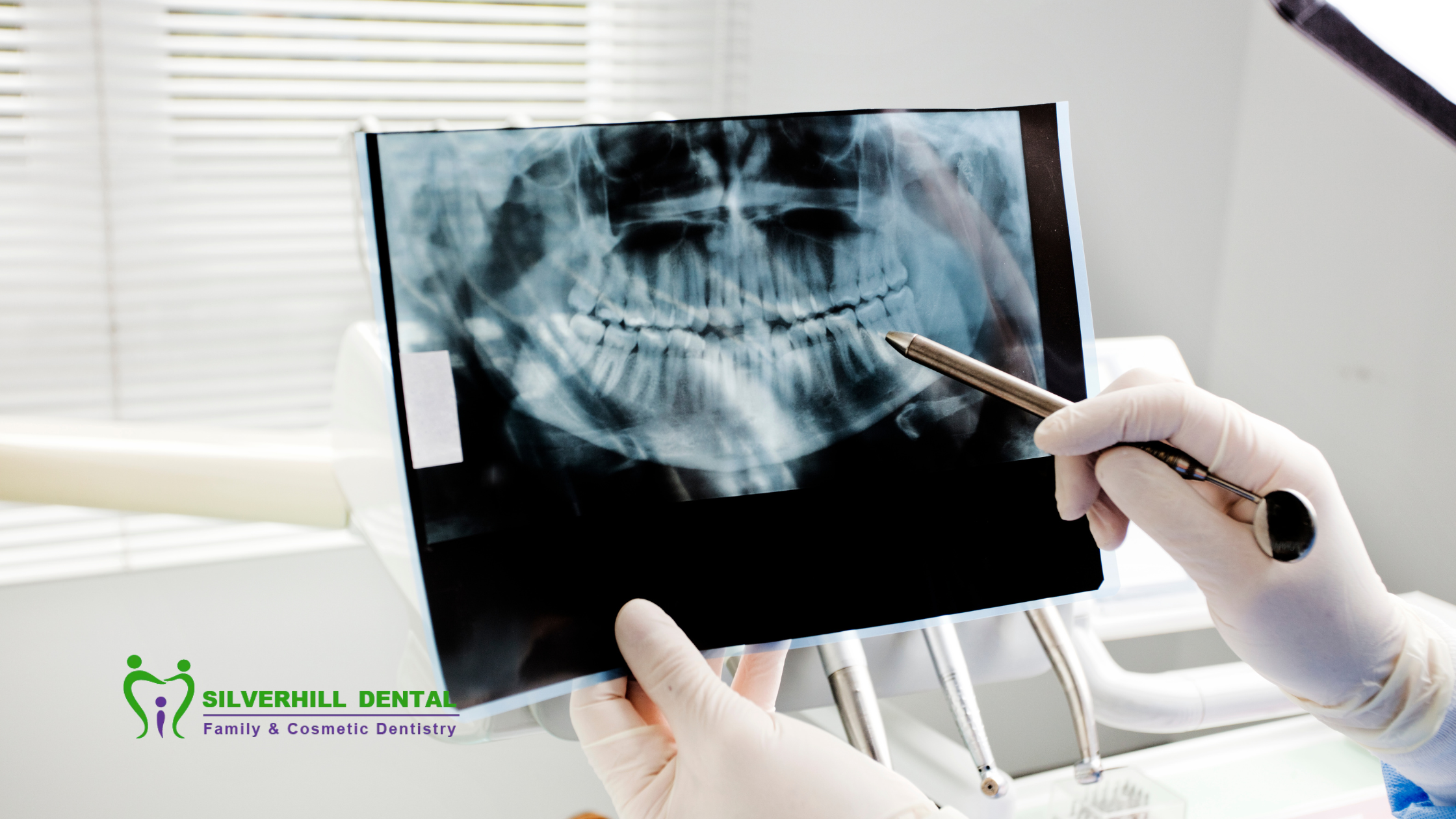 Common Oral Surgeries and Their Recovery Times