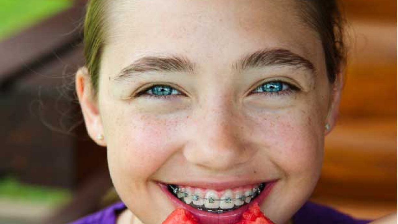 Suitable food for orthodontics