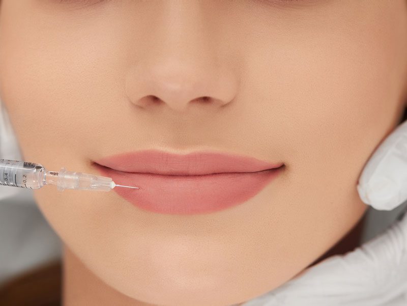 Botox at the Dental Office