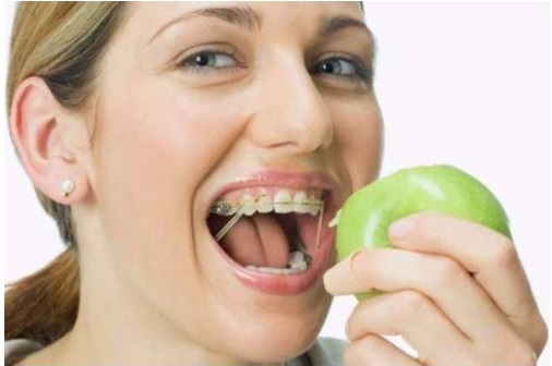 harmful foods during orthodontics