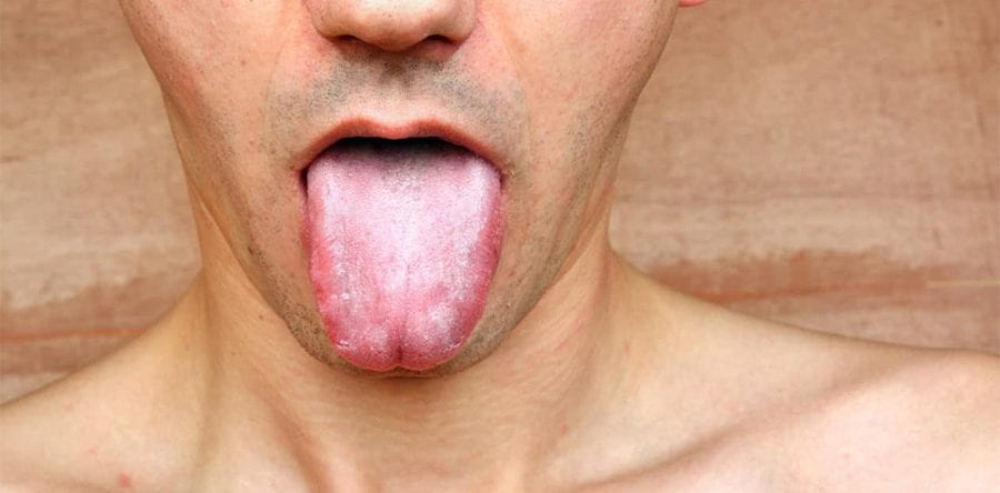 Dry Mouth
