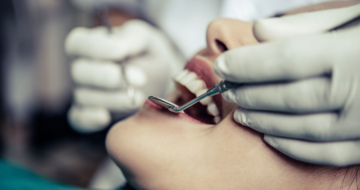 Dental Filling