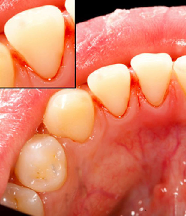 What is a PERIODONTIST?