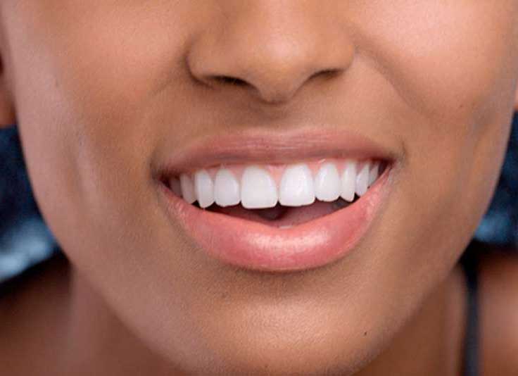 Black Gums
