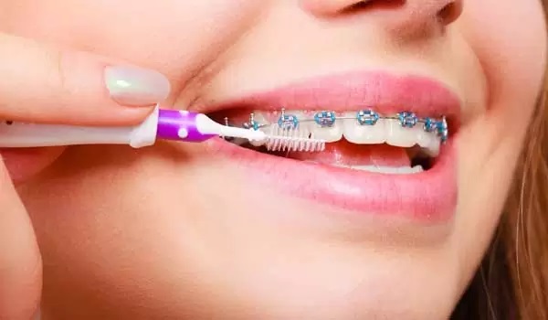 orthodontic toothbrush