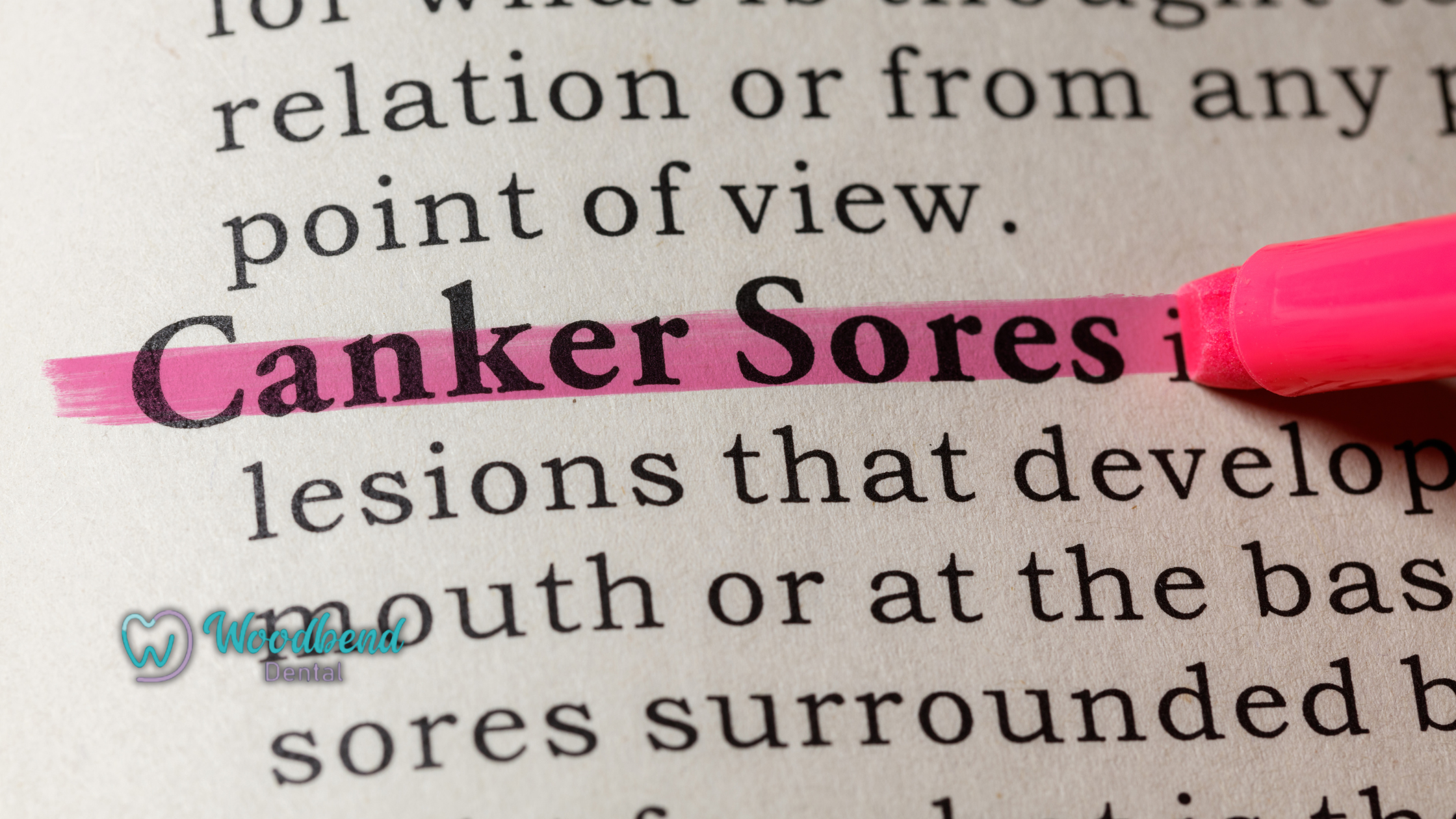 How to Manage Canker Sores Naturally and Medically