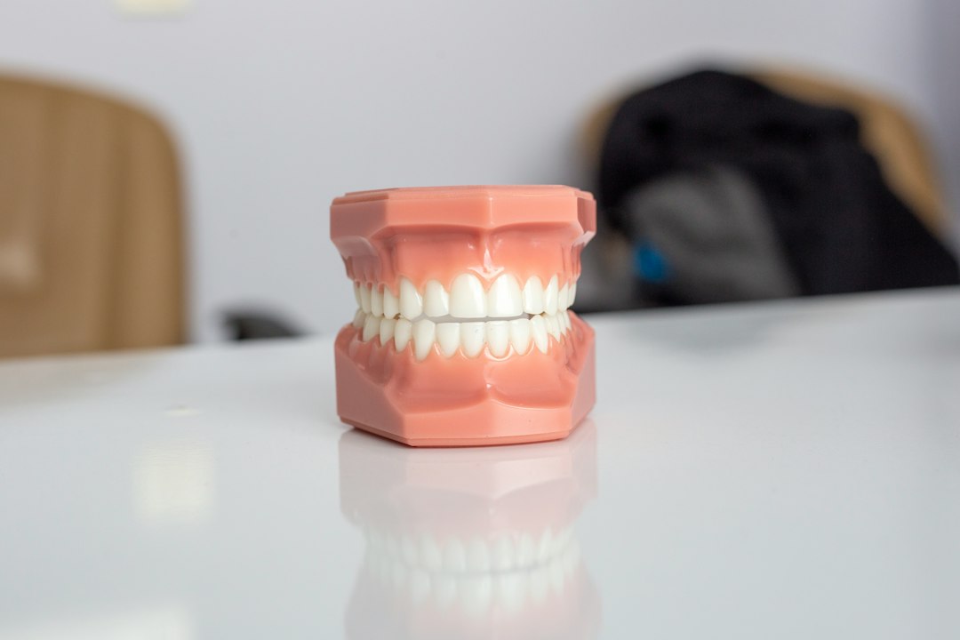Teeth Whitening and Oral Health in Toronto