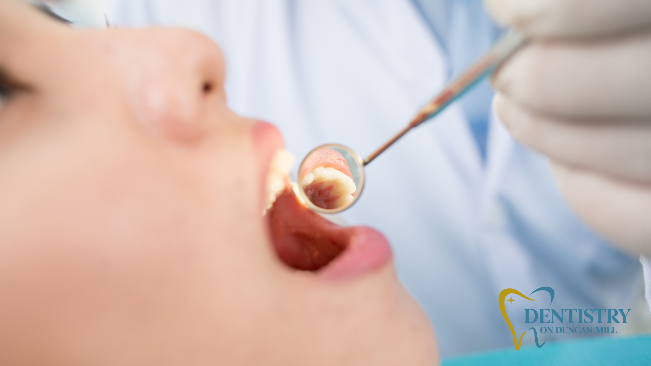 What Your Dentist Can Tell About Your Diet From Your Mouth