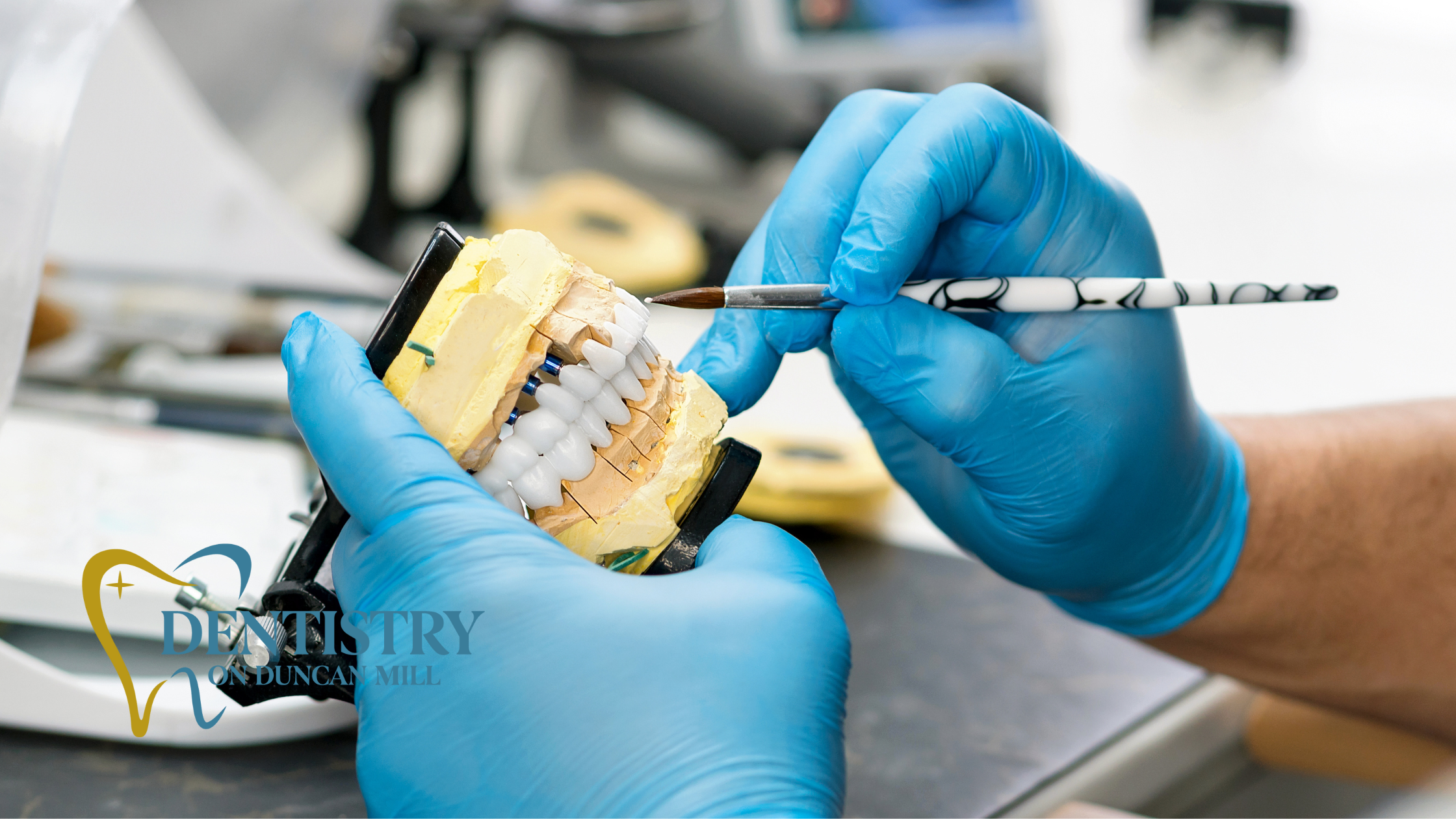 Signs That You Might Need a Full-Mouth Reconstruction