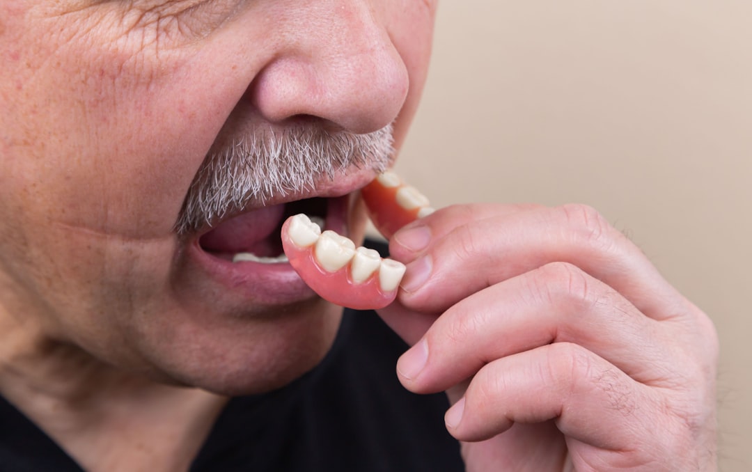 Photo teeth aligners