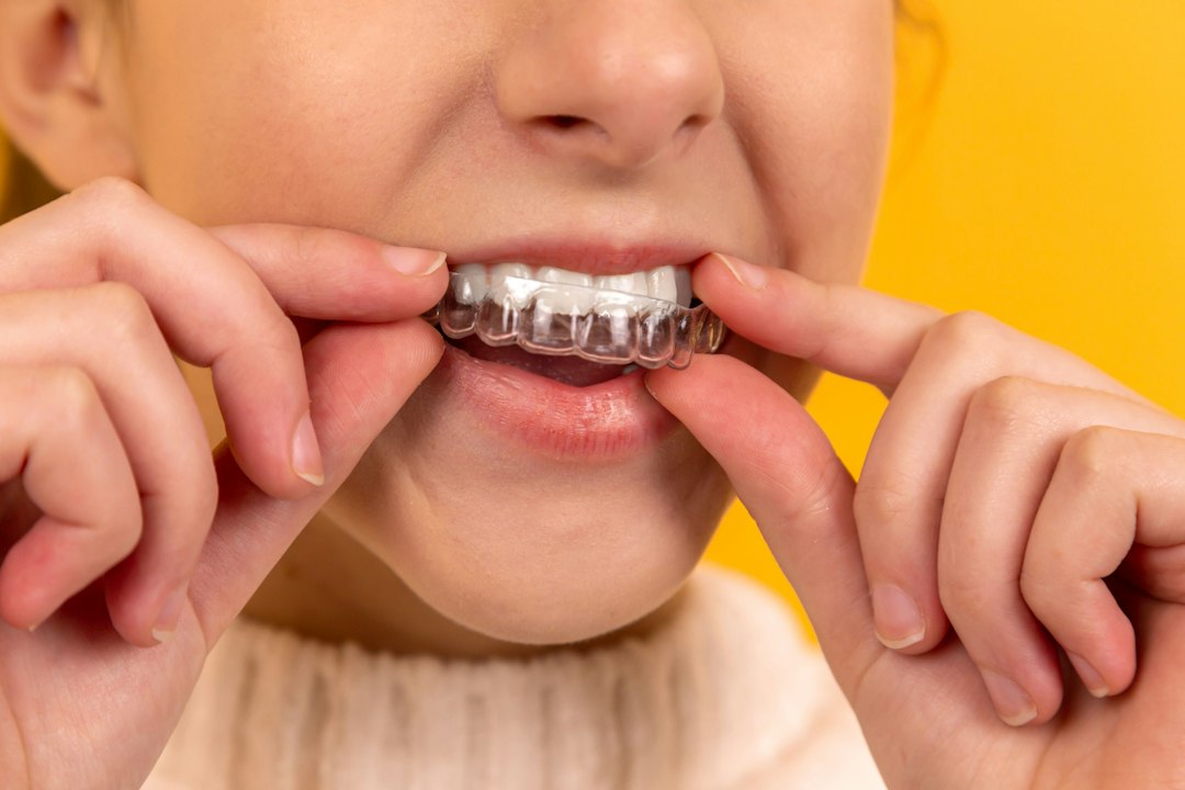 Teeth Whitening and Oral Health in Toronto