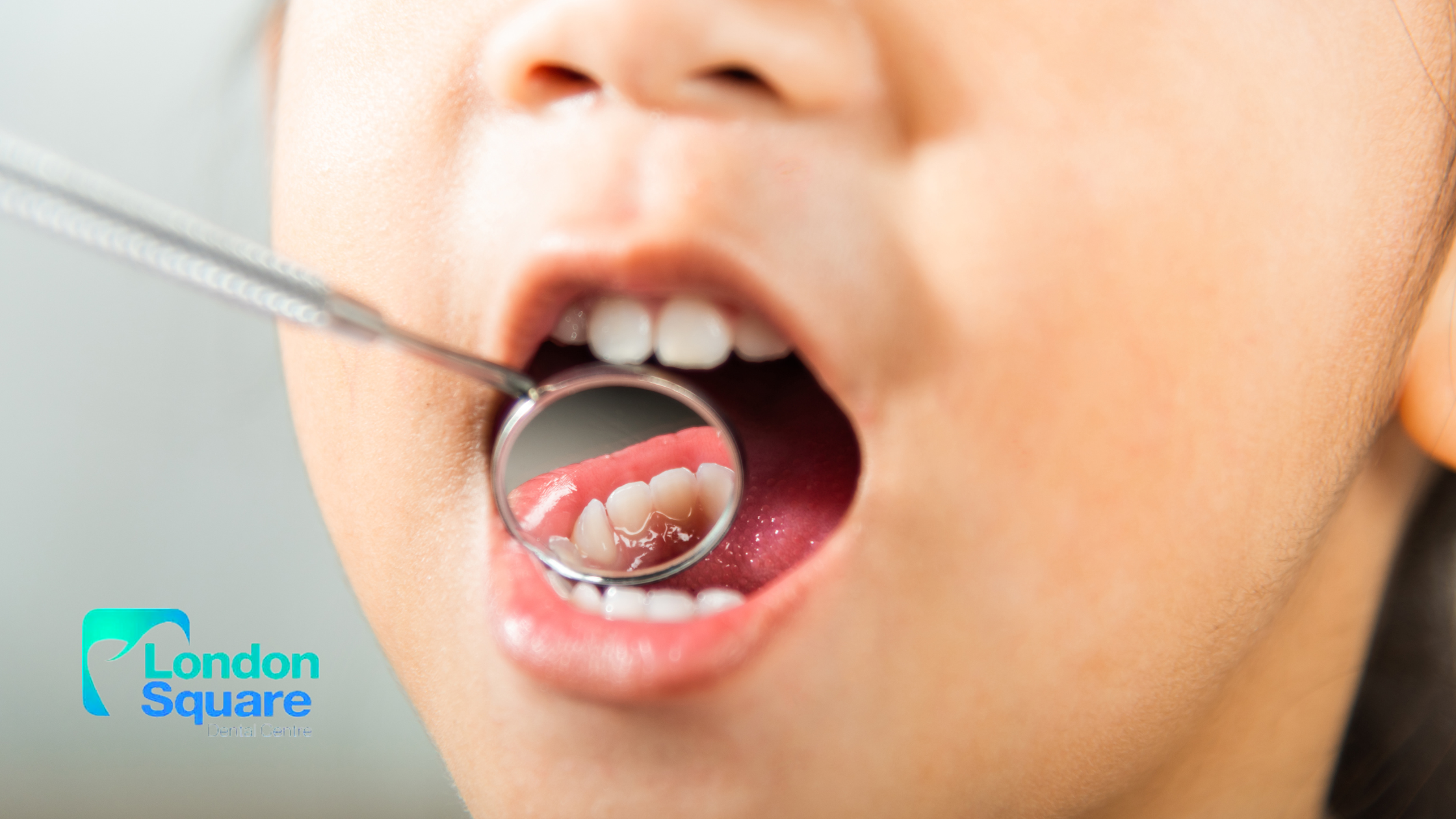 How to Spot Signs of Oral Health Issues in Children