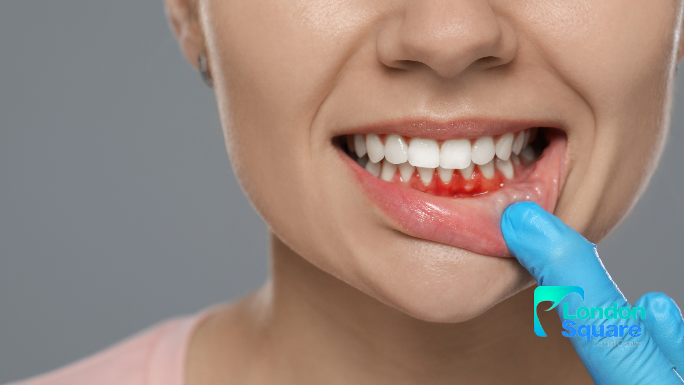 The Importance of Treating Gum Disease Before Cosmetic Dentistry