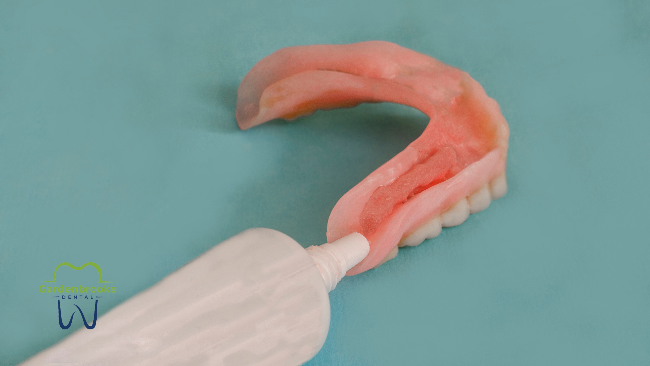 The Science Behind Dental Adhesive Failures