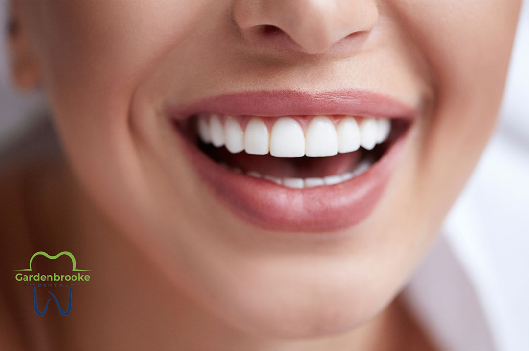 How to Get the Best Results from Teeth Whitening