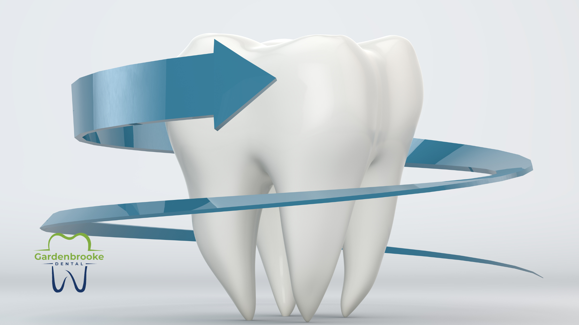 The Role of Cosmetic Contouring (Tooth Reshaping) in Shaping the Perfect Smile