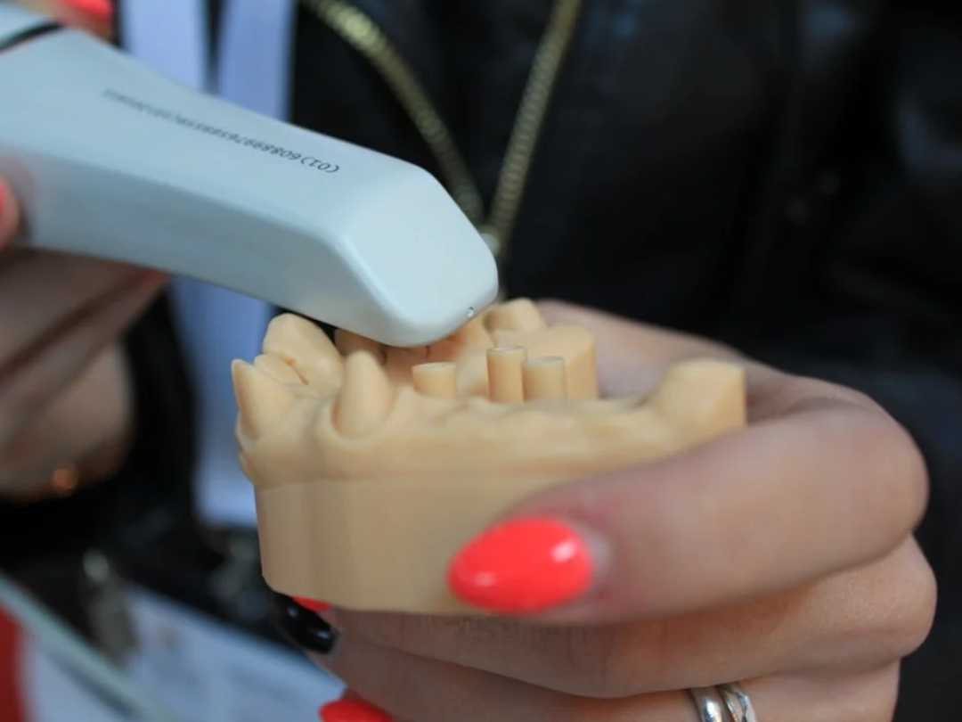 Understanding Root Canal Treatment: What It Is and Why It’s Needed