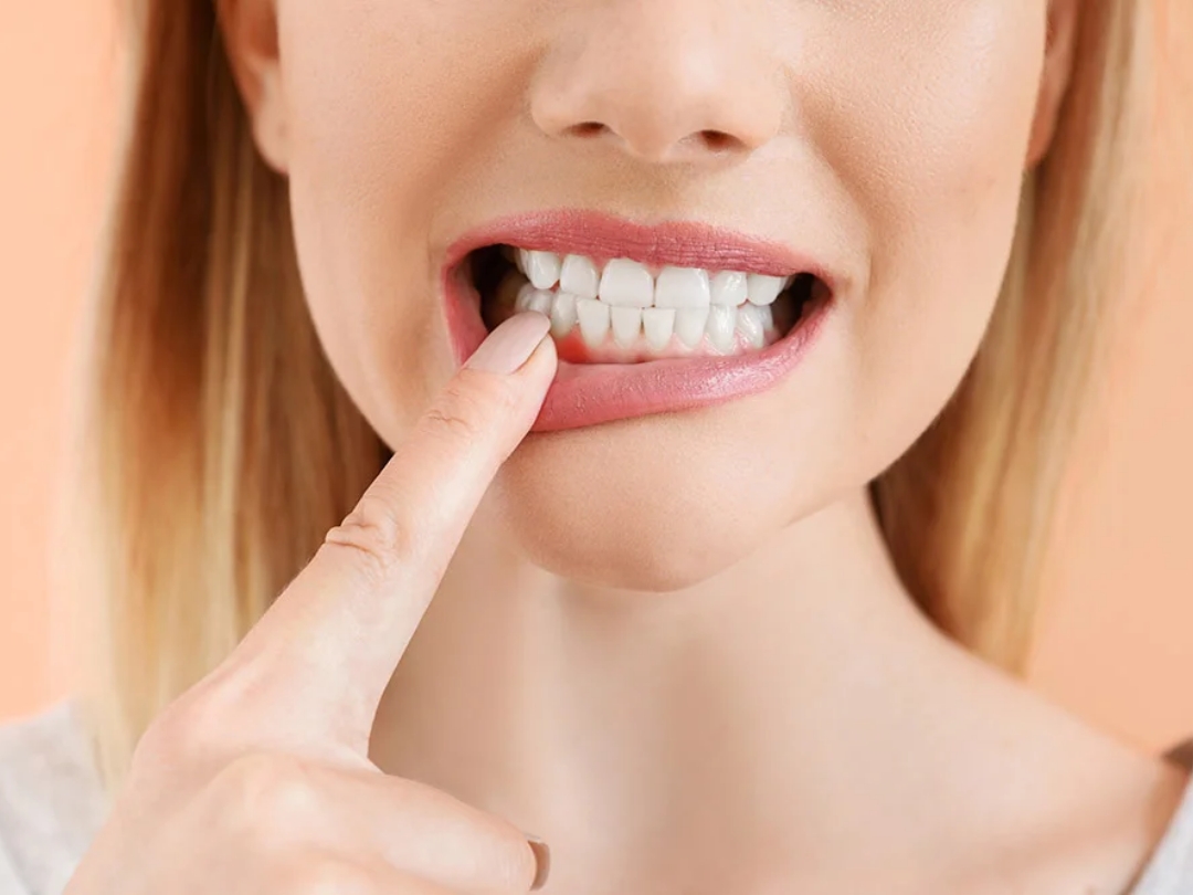 Why Do People Need To Wear Retainers After Braces