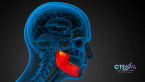 Do You Need a Bone Graft Before Dental Implants?