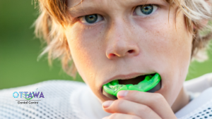 Why Custom-Fit Mouthguards Offer Better Protection