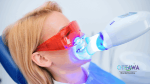 Laser Dentistry – Benefits and Use Cases in Everyday Dental Care