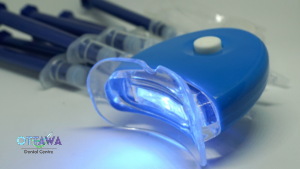The Pros and Cons of DIY Teeth Whitening Kits
